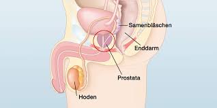 Këto janë simptomat e prostatës tek meshkujt.